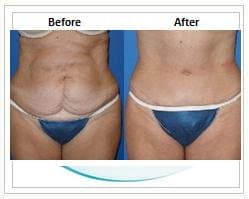 Slider image (5) Aesthetic Cosmetic Plastic Surgery Center Bolivia - SensualBodyDream